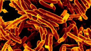 Long a dream, it’s now real: a fast and accurate TB test that doesn’t need phlegm