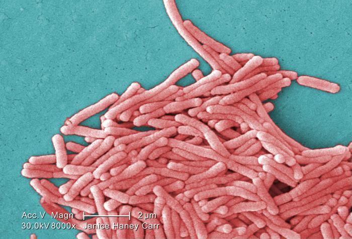 19 Legionella bacteria infections linked to Kaiser Bay Area hospital