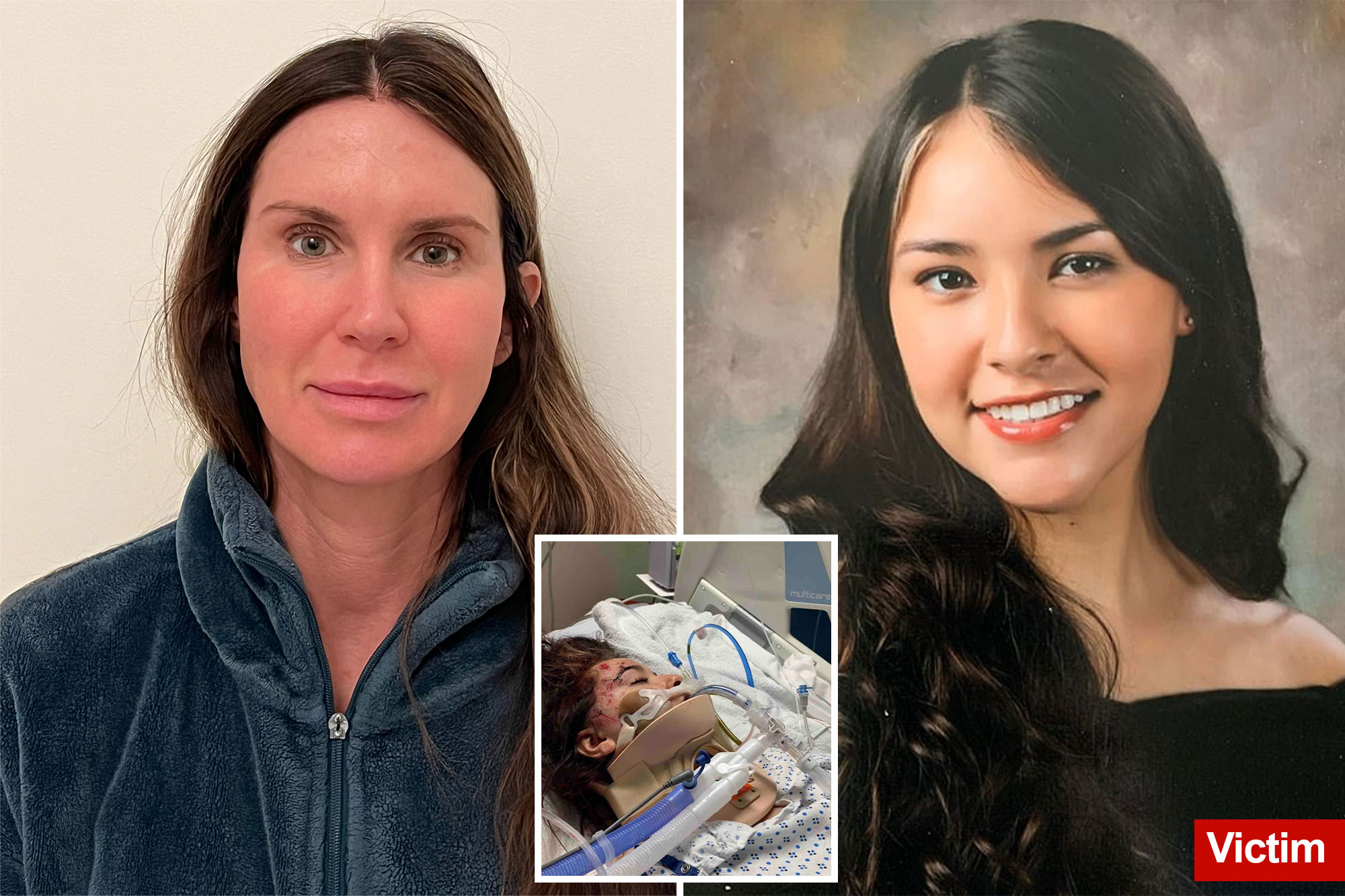 Wealthy mom who maimed young woman in drunken wreck got posh prison stay, quick release thanks to ‘political favoritism’: court docs