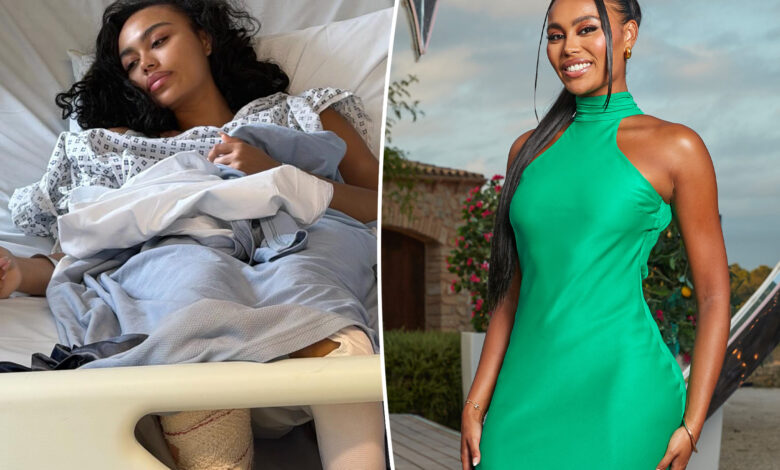 ‘Love Island UK’ star rushed to hospital for emergency surgery after ‘freak accident’ involving glass bottle