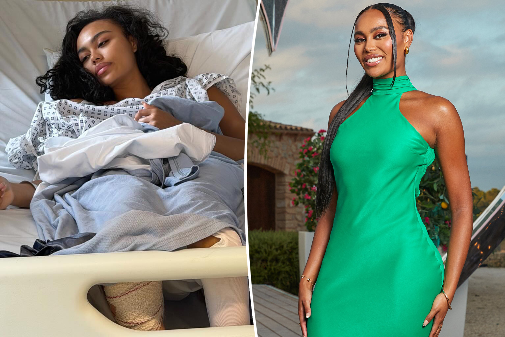 ‘Love Island UK’ star rushed to hospital for emergency surgery after ‘freak accident’ involving glass bottle